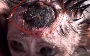 A small injured monkey with severe head wounds after a fire incident, highlighting the need for stronger wildlife protection and safety measures.